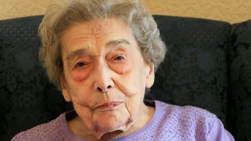 Нет мужчин – нет стресса: 106-летняя жительница Британии раскрыла секрет долголетия