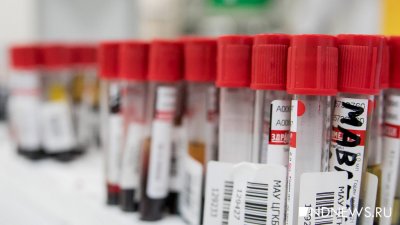 На бесплатное тестирование на антитела к коронавирусу записались 18 тысяч уральцев