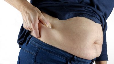 Половина женщин и треть мужчин в России страдают ожирением