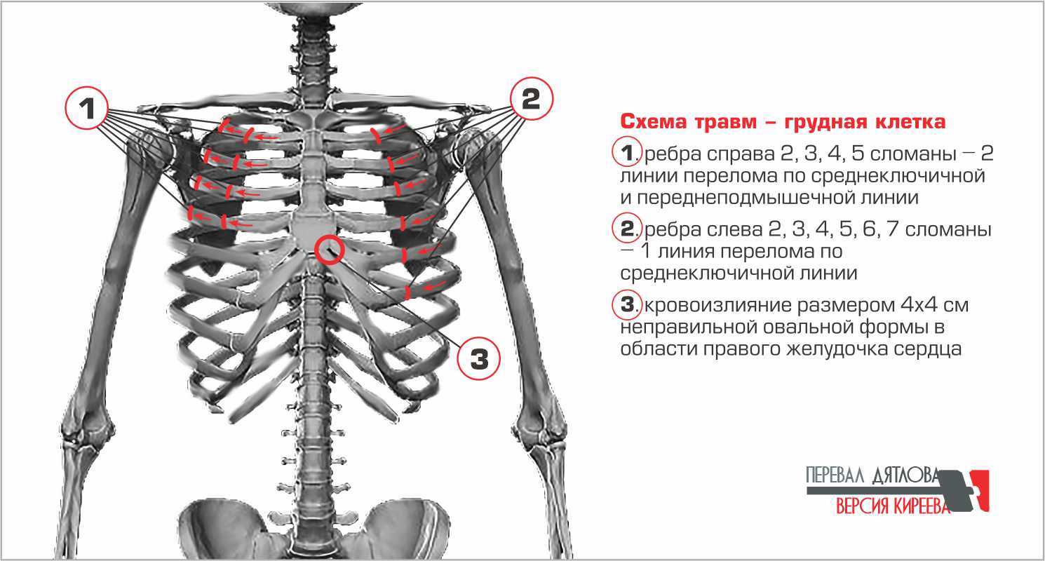 Дятловцы / Как убили Людмилу Дубинину