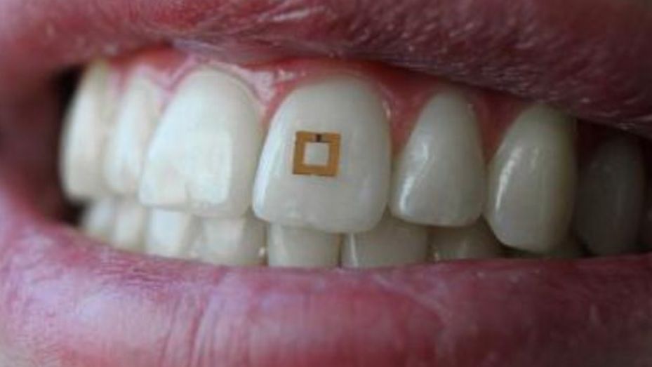 Ученые создали зубной датчик для контроля за качеством питания