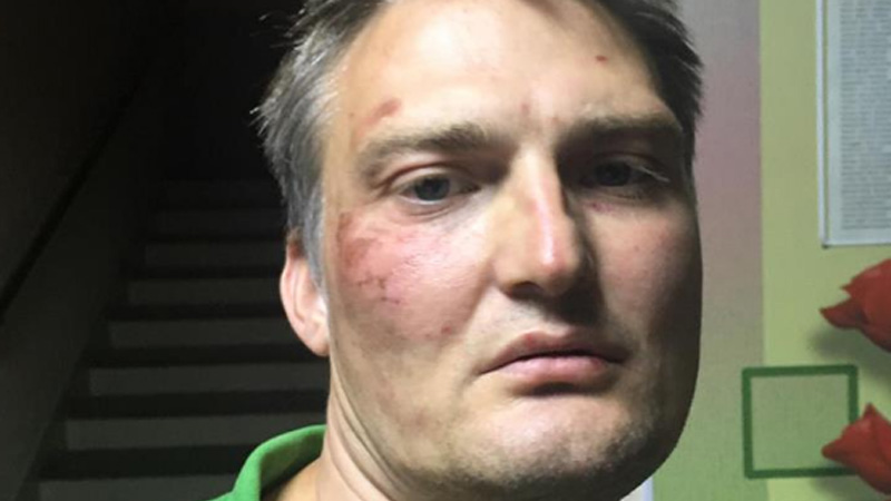 «Били, душили, бросали лицом на асфальт»: полиция ответит за избиение адвоката в Краснодаре, пообещали его коллеги