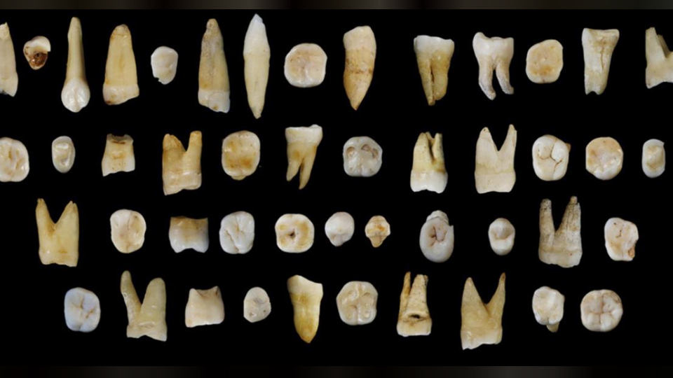 В стене старого дома в США нашли тысячу человеческих зубов