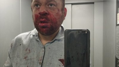В Югорске совершено нападение на бывшего депутата