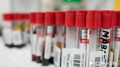 256 новых случаев коронавируса выявили за сутки в Югре