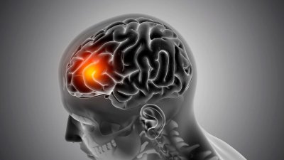 Ученые вырастили больной шизофренией искусственный мозг