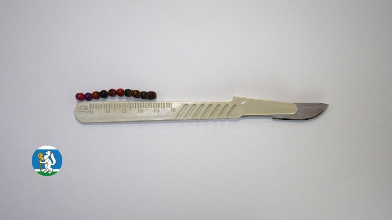 Екатеринбургские врачи спасли девочку, проглотившую 10 магнитных шариков (ФОТО)