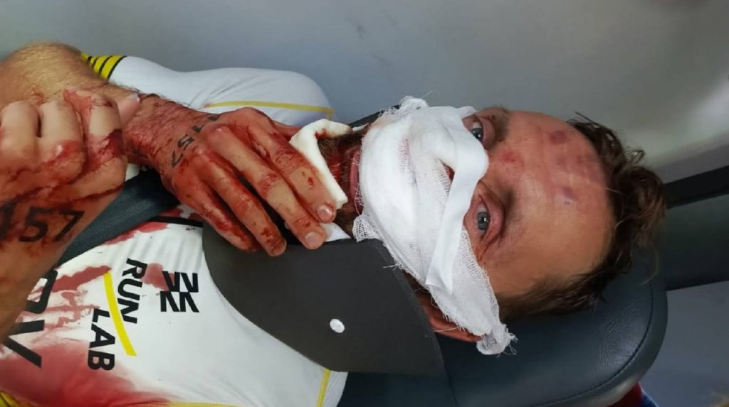 Известный триатлонист оказался в реанимации после столкновения на гонке в Москве